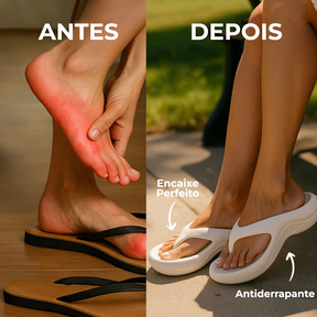 Sandália Anatômica - NuvemPé®